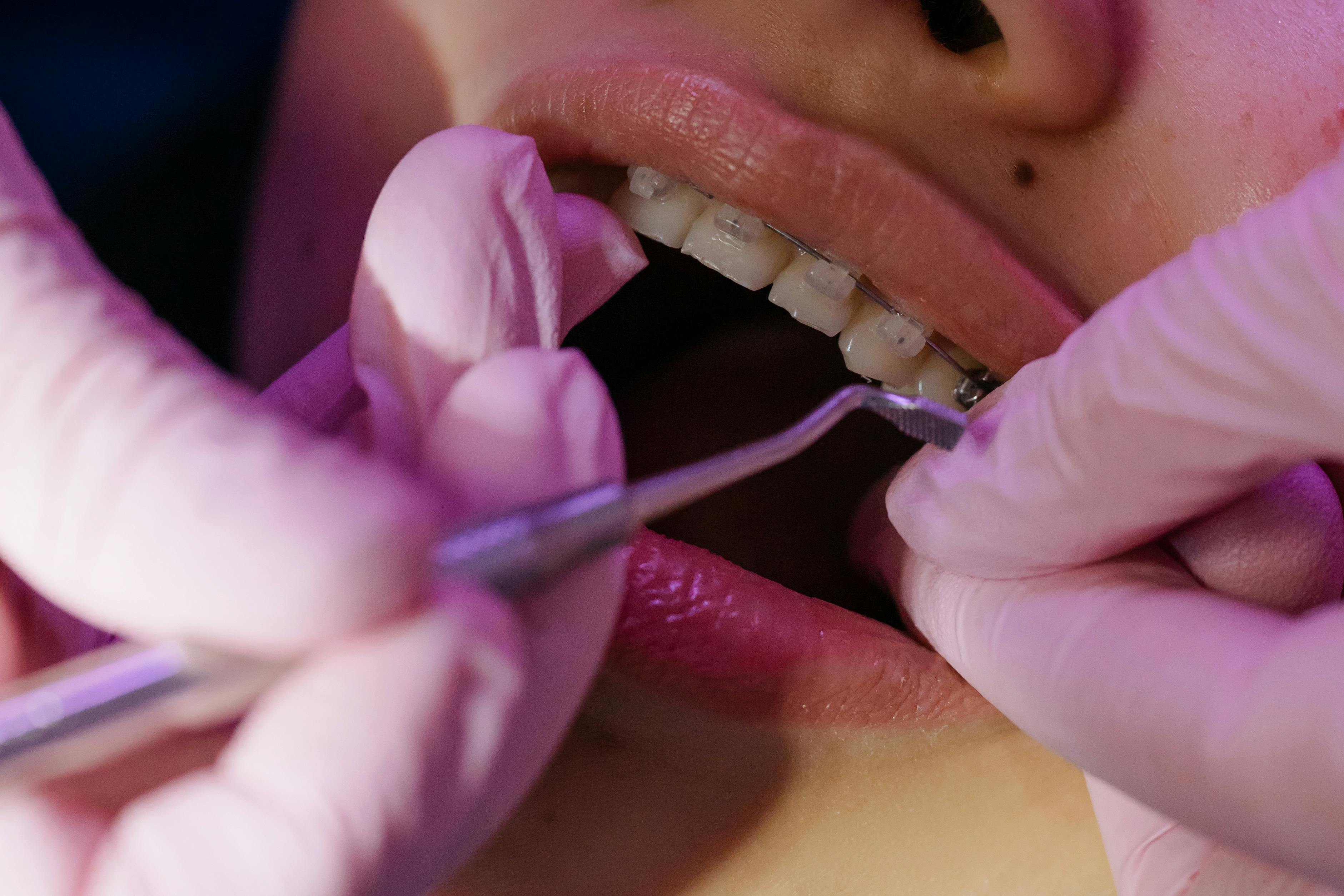 Orthodontie adulte traitement dentaire